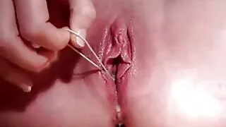გამხდარი Min con
